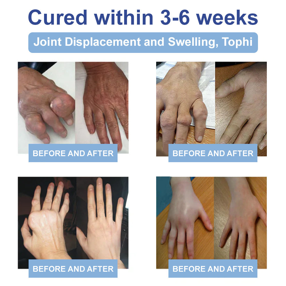 ✅Officially Recommended KUBOZN® Advanced Magnesium Pain Relief Cream (Treats Arthritis, Neuropathy, Rheumatism, Sports Injuries & More)