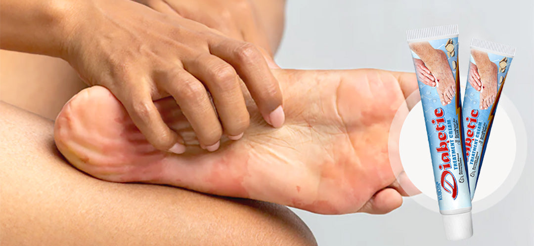 KUBOZN®VitaGluco Diabetes Treatment Cream image KUBOZN®VitaGluco Diabetes Treatment Cream