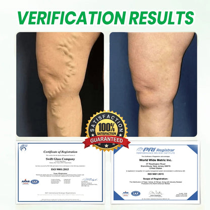 KUBOZN® Lymphatic Detox Herbal Cream