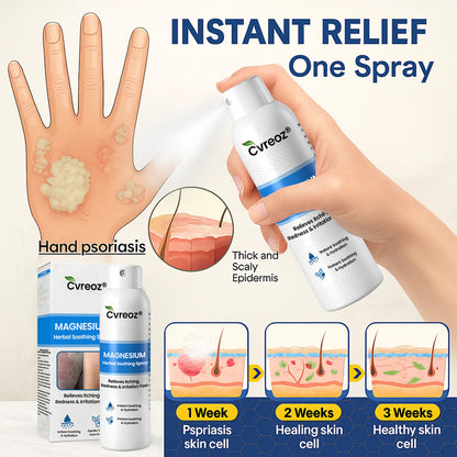 ✅ Official Store: Cvreoz® Magnesium Herbal Psoriasis Spray 👨‍⚕️ MHRA Approved (Relieves psoriasis and eczema, improves bacterial infections in the genital area, treats acne and warts) (Copy)