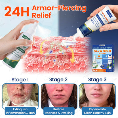 KUBOZN® Psoriasis Day & Night Repair System - 100% Steroid-Free Relief Duo for Plaques, Scaling & Itch (offer)