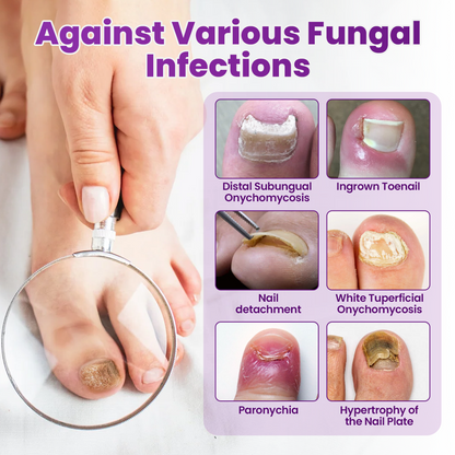 Cvreoz® AeroFilm Foot Defense Mist