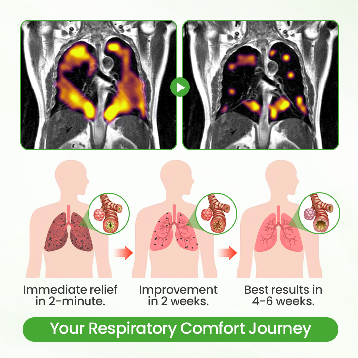 T Healrize® HerbaAir Mullein Lung Purifier