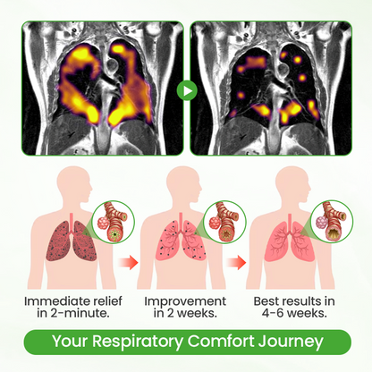 T Healrize® HerbaAir Mullein Lung Purifier