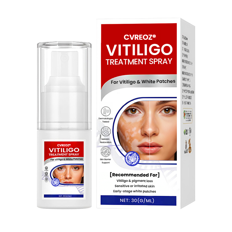 Cvreoz® Vitiligo Treatment Spray 🌿 Herbal Formula Certified — (Supports Repigmentation, Prevents New Spots, and Restores Natural Skin Tone Without Steroids) (Offer)