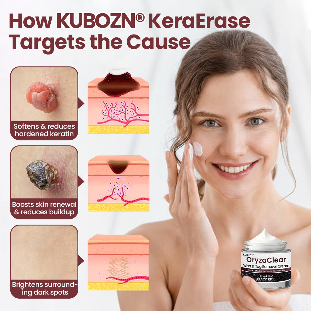 ⭐KUBOZN® OryzaClear – Black Rice Softening Cream · Botanical Care for Skin Tags & Uneven Texture BIGO