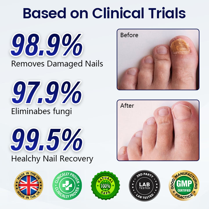 Healrize® Anti-Fungal Nail Repair Patch (offer)