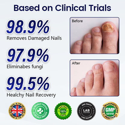 Healrize® Anti-Fungal Nail Repair Patch (offer)
