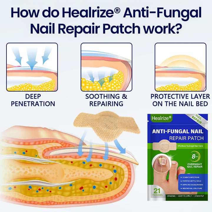 Healrize® Anti-Fungal Nail Repair Patch (offer)