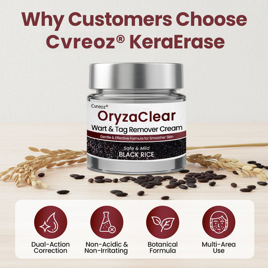 Cvreoz® OryzaClear Black Rice Botanical Keratin-Softening Cream 🌿 Dermatologist Approved (Softens skin tags & bumps, dissolves keratin buildup, brightens dark spots, safe for sensitive areas) BIGO