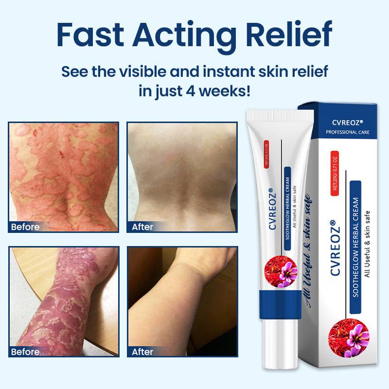 CVREOZ® SootheGlow Herbal Cream