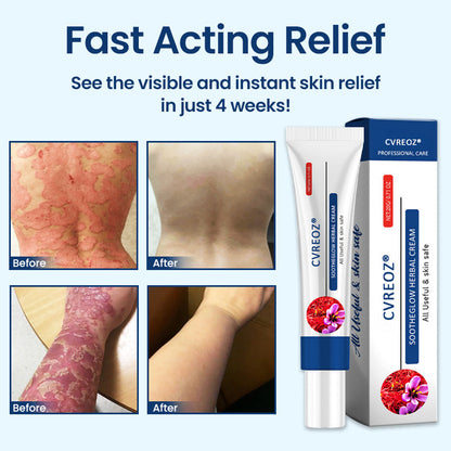 CVREOZ® SootheGlow Herbal Cream