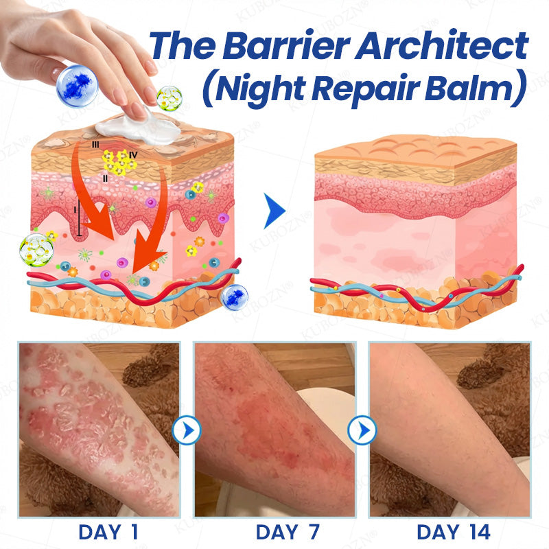 KUBOZN® Psoriasis Day & Night Repair System - 100% Steroid-Free Relief Duo for Plaques, Scaling & Itch (offer)