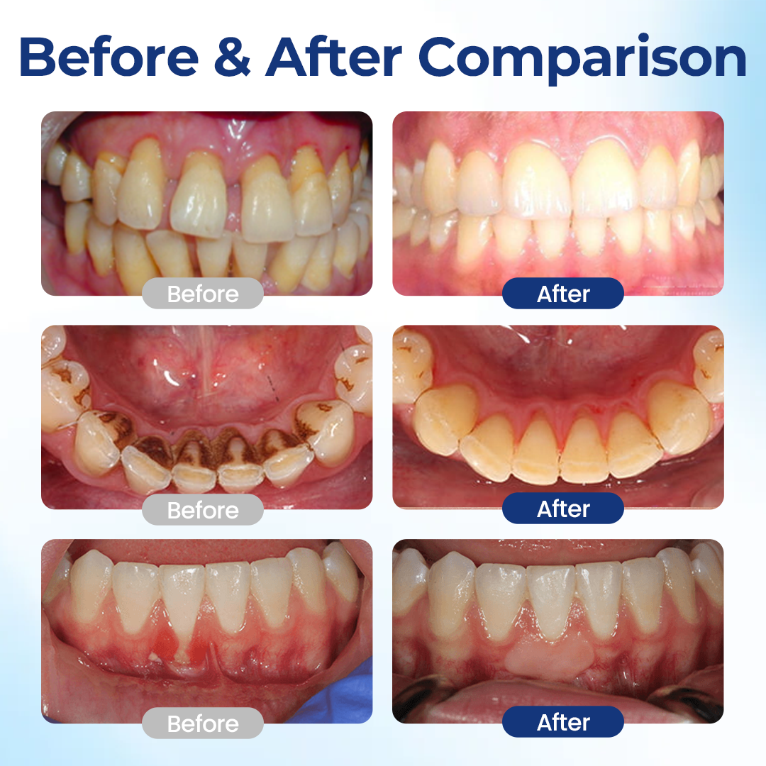 KUBOZN® BeeTakt Oral+ GUM REPAIR (Offer)