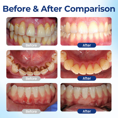 KUBOZN® BeeTakt Oral+ GUM REPAIR (Offer)