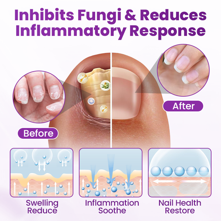 Cvreoz® AeroFilm Foot Defense Mist