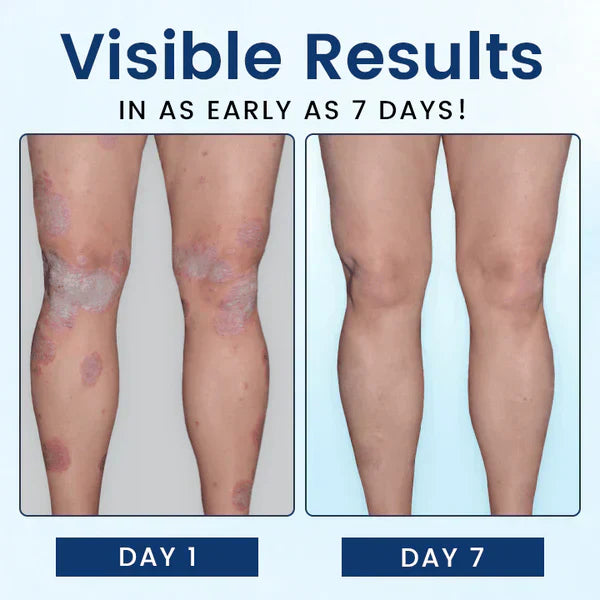 CVREOZ® SootheGlow Herbal Cream