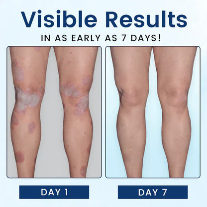 CVREOZ® SootheGlow Herbal Cream