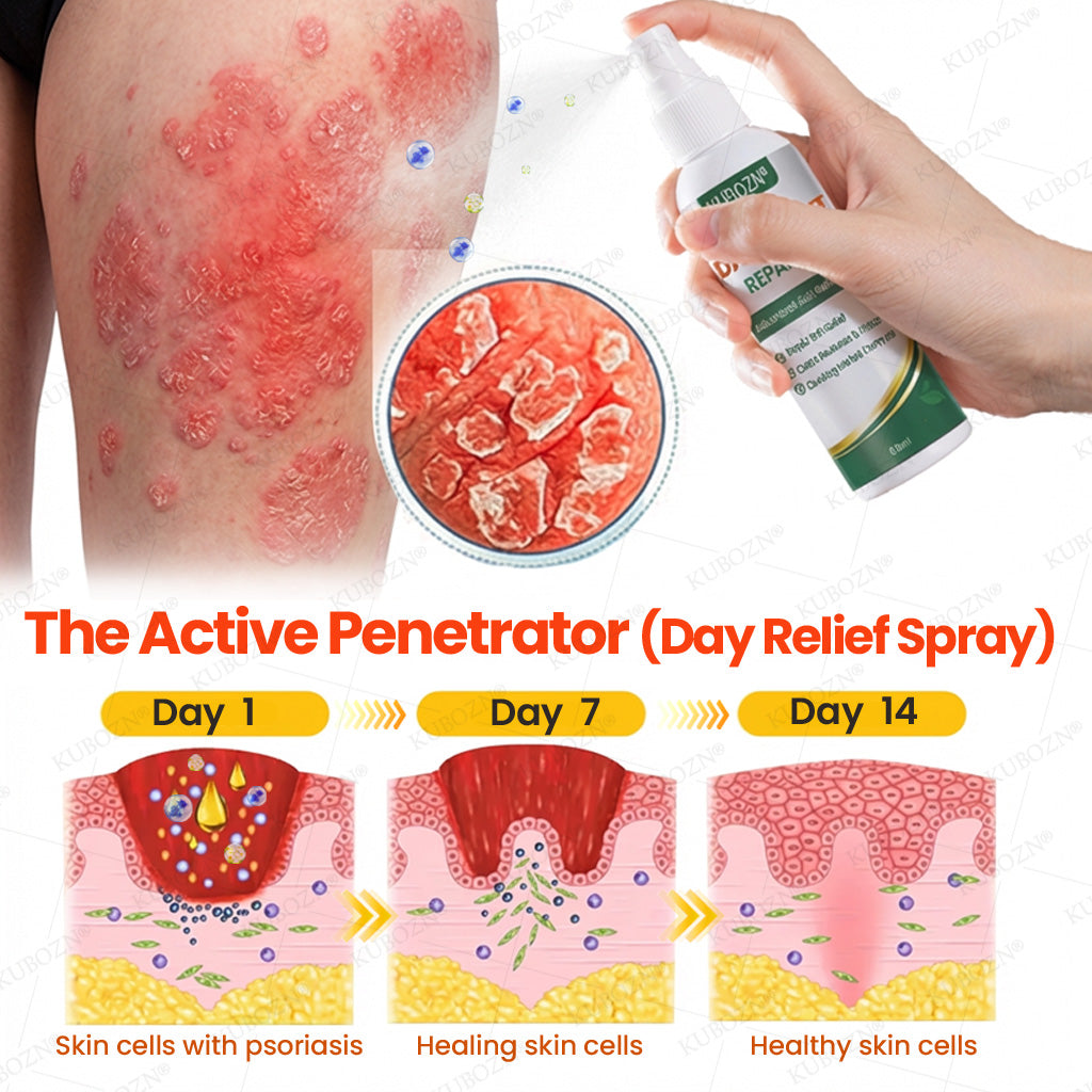 KUBOZN® Psoriasis Day & Night Repair System - 100% Steroid-Free Relief Duo for Plaques, Scaling & Itch (offer)