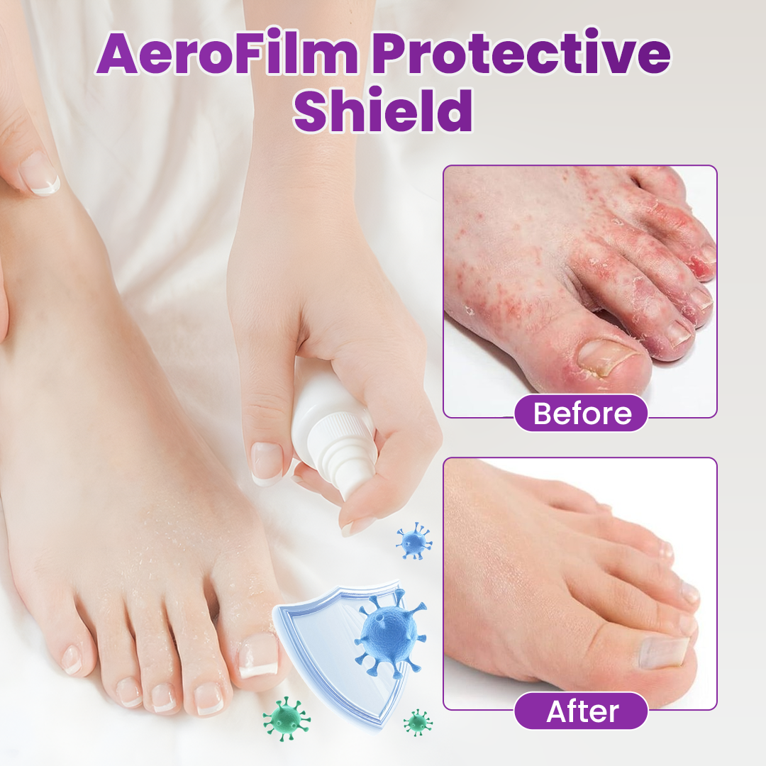 Cvreoz® AeroFilm Foot Defense Mist