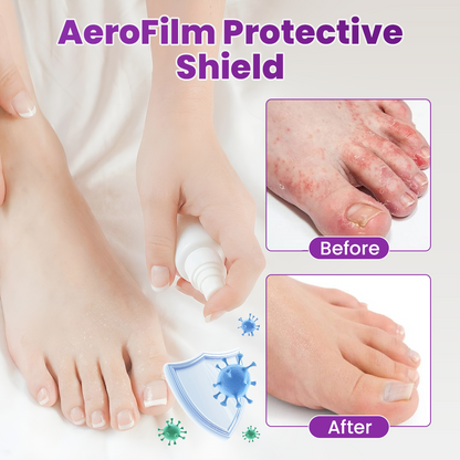 Cvreoz® AeroFilm Foot Defense Mist