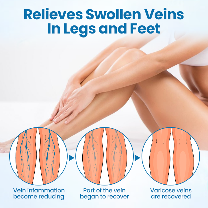 ⚡Cvreoz® VeinGuard Herbal Spray