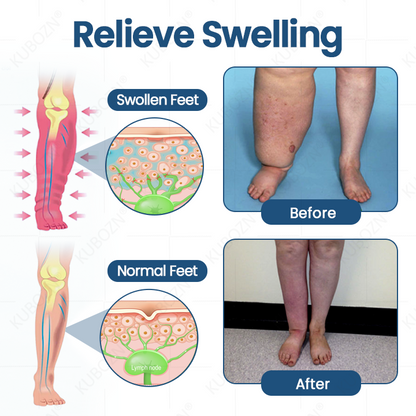 KUBOZN® Roll-On Cream for Lymphatic Drainage & Swelling Relief (Offer)