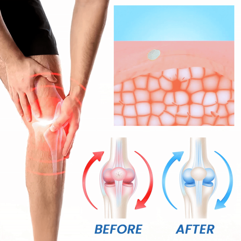 KUBOZN® Advanced Magnesium Absorption Cream for Arthritis, Neuropathy & Joint Pain